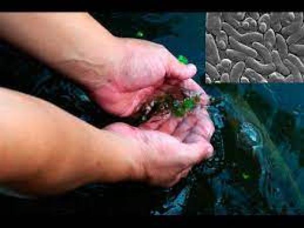 تسجيل رقم قياسي باليابان في حالات الإصابة بالبكتيريا "آكلة اللحوم"